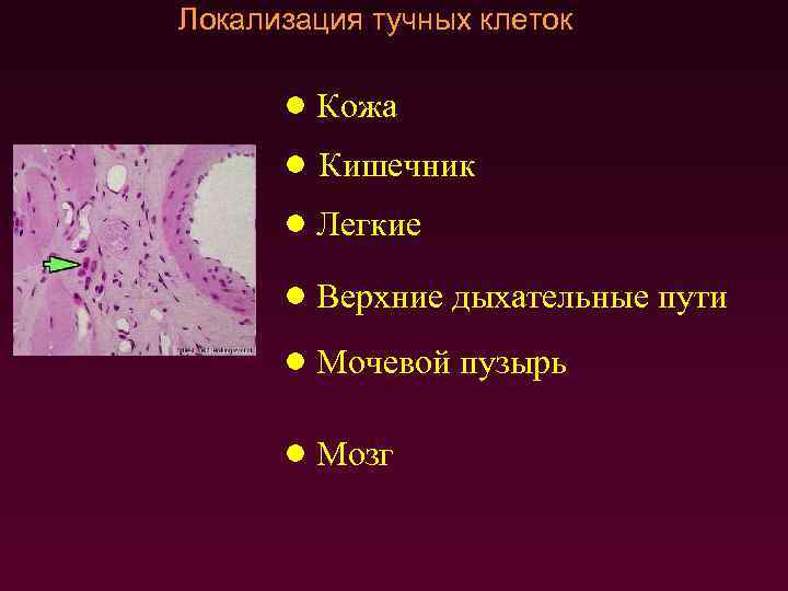 Локализация тучных клеток Кожа Кишечник Легкие Верхние дыхательные пути Мочевой пузырь Мозг 