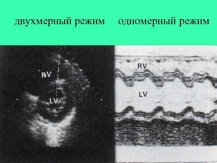 двухмерный режим одномерный режим 