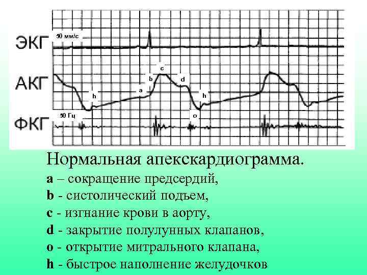 50 мм/с c b h 50 Гц d a h o Нормальная апекскардиограмма. а