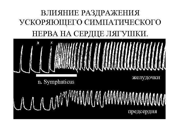 ВЛИЯНИЕ РАЗДРАЖЕНИЯ УСКОРЯЮЩЕГО СИМПАТИЧЕСКОГО НЕРВА НА СЕРДЦЕ ЛЯГУШКИ. n. Symphaticus желудочки предсердия 