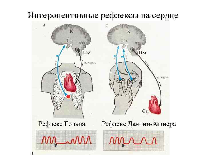 Интероцептивные рефлексы на сердце Рефлекс Гольца Рефлекс Данини-Ашнера 