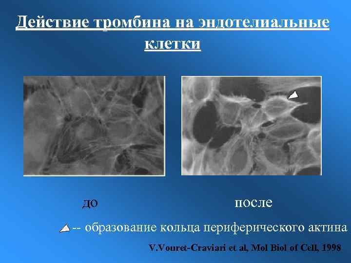 Действие тромбина на эндотелиальные клетки до после -- образование кольца периферического актина V. Vouret-Craviari
