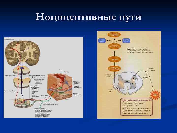 Ноцицептивные пути 
