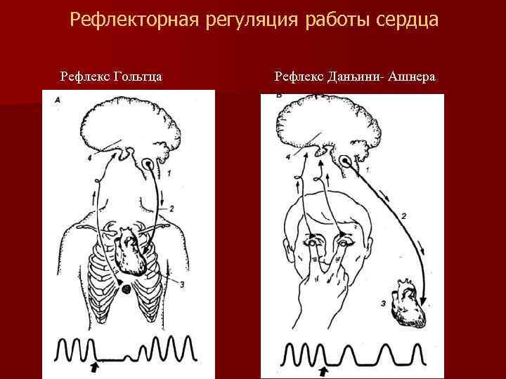 Рефлекторная регуляция работы сердца Рефлекс Гольтца Рефлекс Даньини- Ашнера 