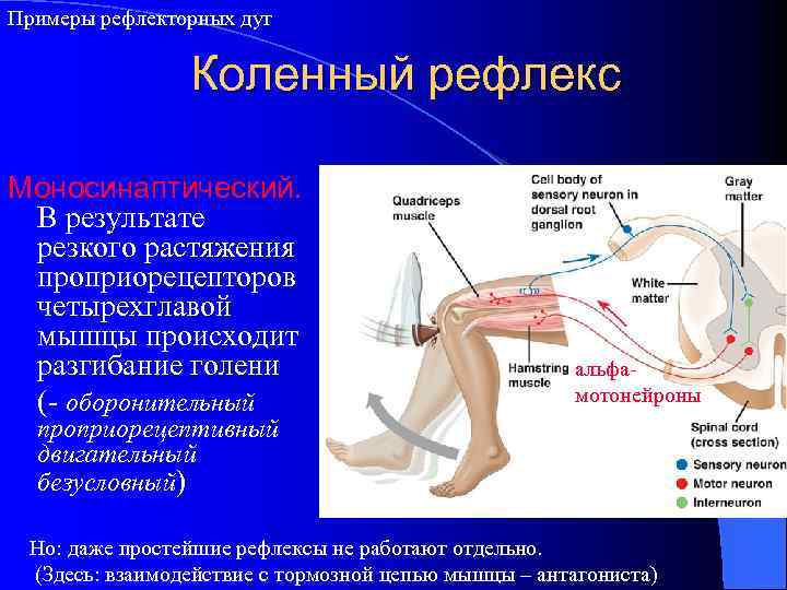 Примеры рефлекторных дуг Коленный рефлекс Моносинаптический. В результате резкого растяжения проприорецепторов четырехглавой мышцы происходит