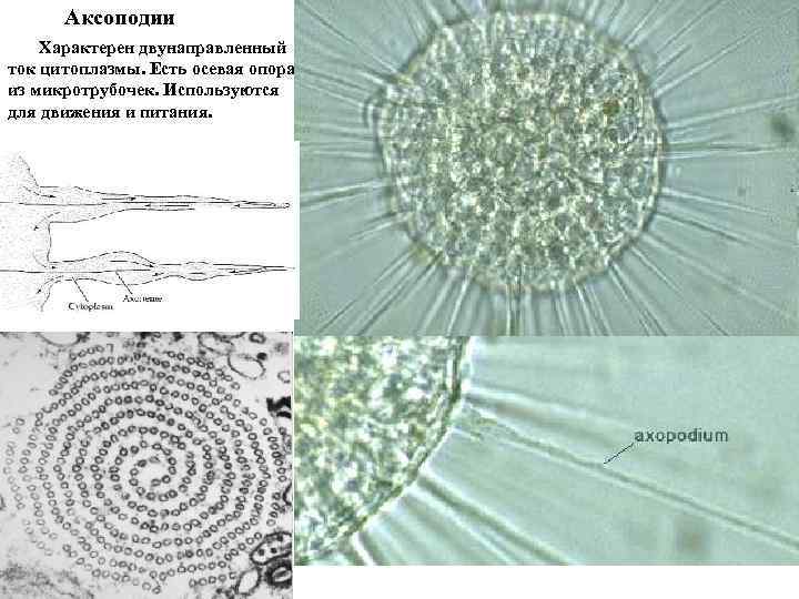 Аксоподии Характерен двунаправленный ток цитоплазмы. Есть осевая опора из микротрубочек. Используются для движения и