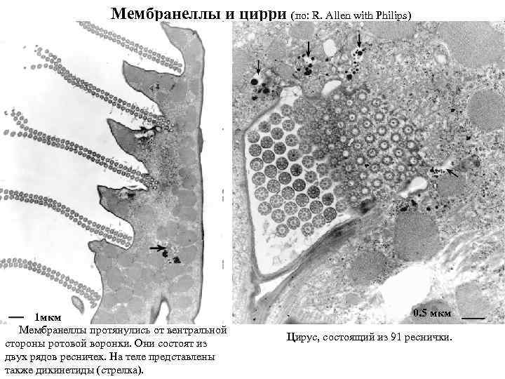 Мембранеллы и цирри (по: R. Allen with Philips) 1 мкм Мембранеллы протянулись от вентральной