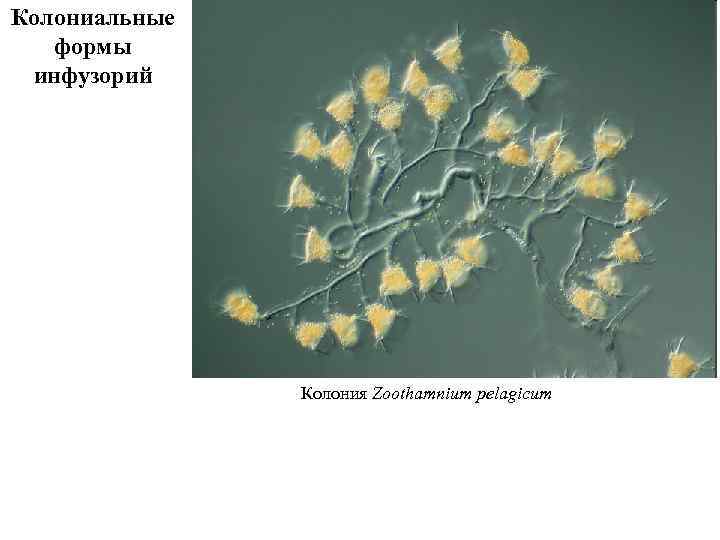 Колониальные формы инфузорий Колония Zoothamnium pelagicum 