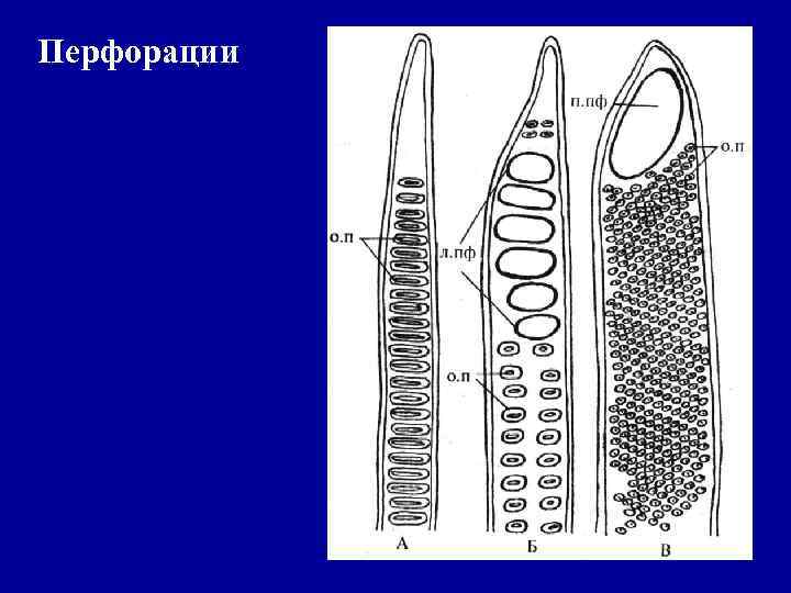 Перфорации 