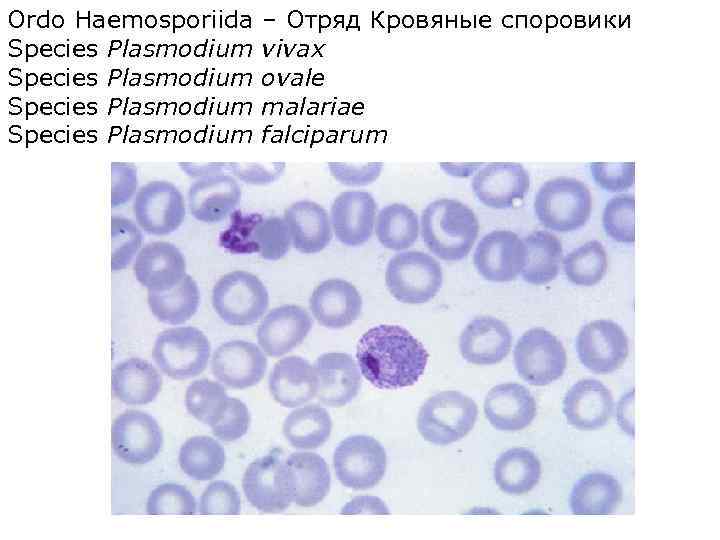 Ordo Haemosporiida Species Plasmodium – Отряд Кровяные споровики vivax ovale malariae falciparum 