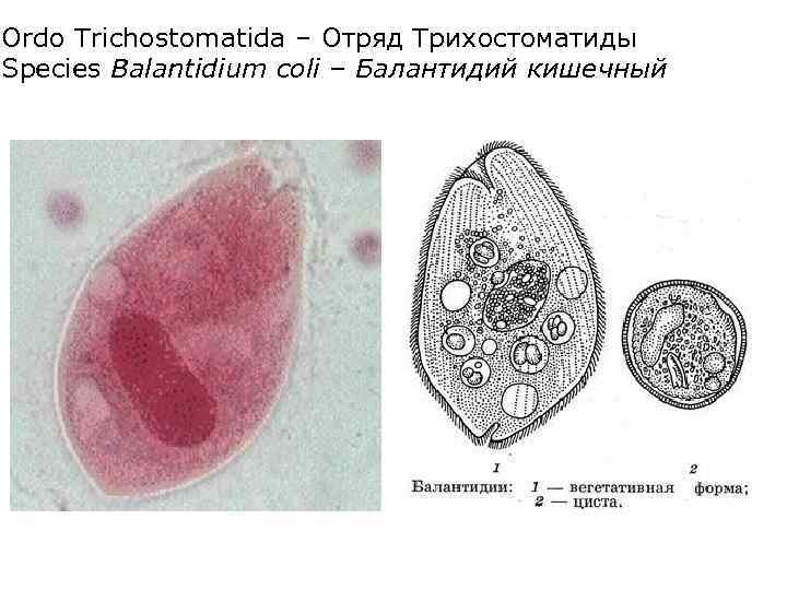 Балантидий строение рисунок