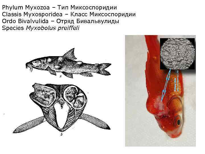 Phylum Myxozoa – Тип Миксоспоридии Classis Myxosporidea – Класс Миксоспоридии Ordo Вivalvulida – Отряд