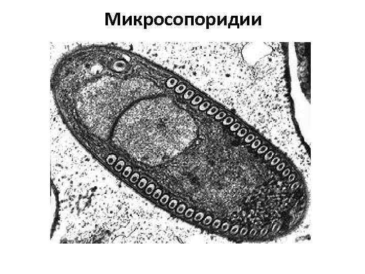 Микросопоридии 