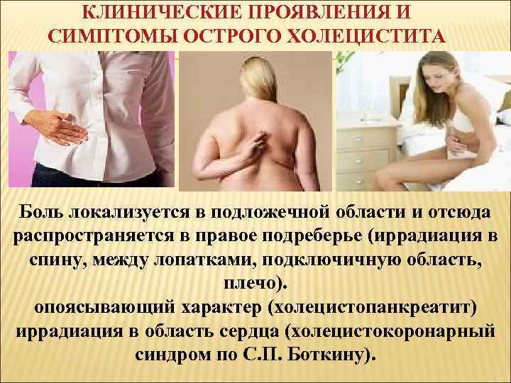 КЛИНИЧЕСКИЕ ПРОЯВЛЕНИЯ И СИМПТОМЫ ОСТРОГО ХОЛЕЦИСТИТА Боль локализуется в подложечной области и отсюда распространяется