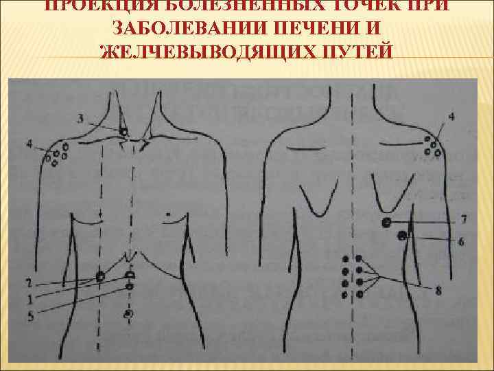 ПРОЕКЦИЯ БОЛЕЗНЕННЫХ ТОЧЕК ПРИ ЗАБОЛЕВАНИИ ПЕЧЕНИ И ЖЕЛЧЕВЫВОДЯЩИХ ПУТЕЙ 
