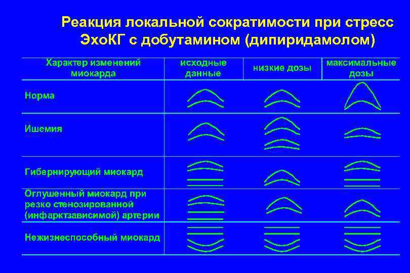 Реакция локальной сократимости при стресс Эхо. КГ с добутамином (дипиридамолом) 