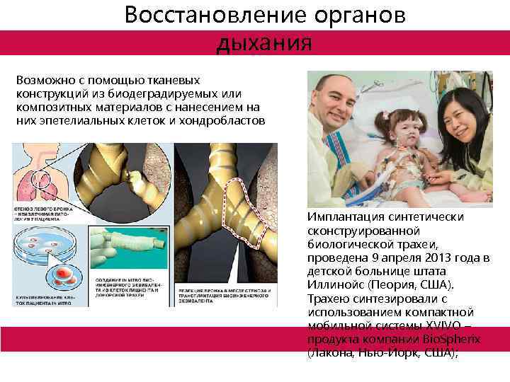 Восстановление органов дыхания Возможно с помощью тканевых конструкций из биодеградируемых или композитных материалов с