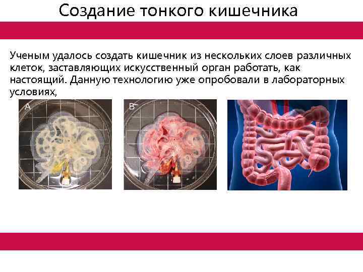 Создание тонкого кишечника Ученым удалось создать кишечник из нескольких слоев различных клеток, заставляющих искусственный