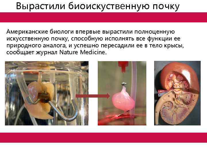 Вырастили биоискуственную почку Американские биологи впервые вырастили полноценную искусственную почку, способную исполнять все функции