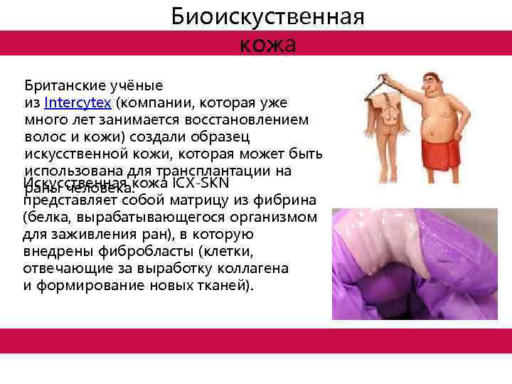 Биоискуственная кожа Британские учёные из Intercytex (компании, которая уже много лет занимается восстановлением волос