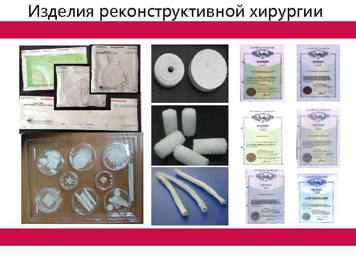 Изделия реконструктивной хирургии 