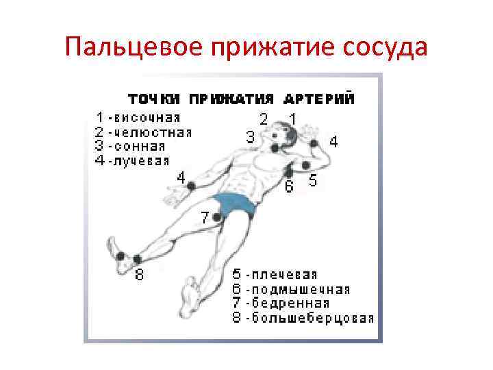 Пальцевое прижатие сосуда 