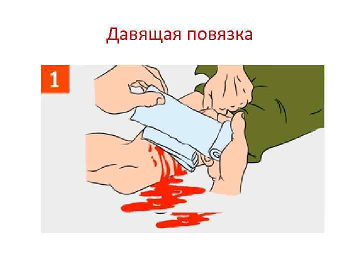 Давящая повязка 
