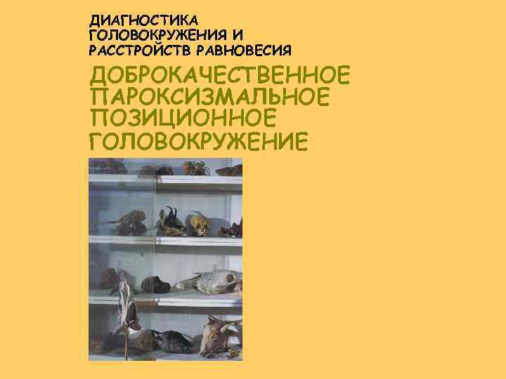 ДИАГНОСТИКА ГОЛОВОКРУЖЕНИЯ И РАССТРОЙСТВ РАВНОВЕСИЯ ДОБРОКАЧЕСТВЕННОЕ ПАРОКСИЗМАЛЬНОЕ ПОЗИЦИОННОЕ ГОЛОВОКРУЖЕНИЕ 