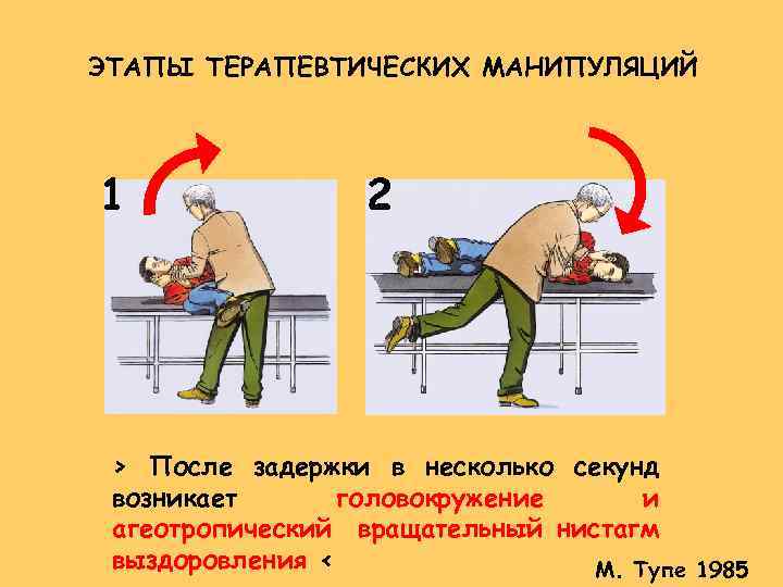 ЭТАПЫ ТЕРАПЕВТИЧЕСКИХ МАНИПУЛЯЦИЙ 1 2 > После задержки в несколько секунд возникает головокружение и