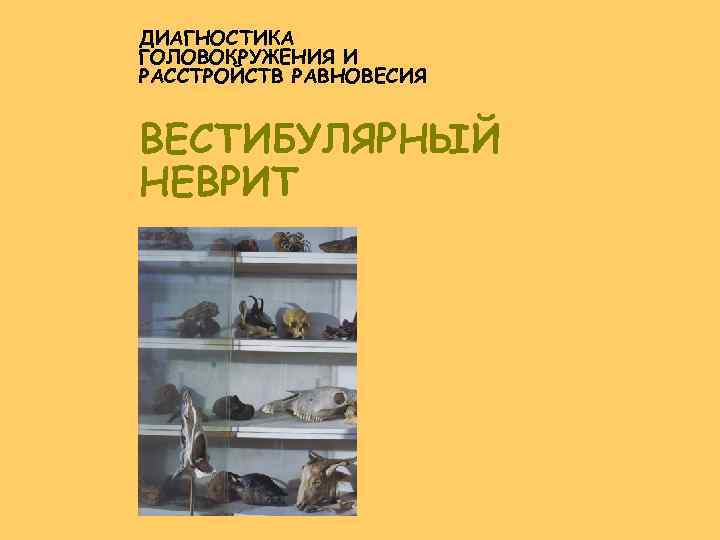 ДИАГНОСТИКА ГОЛОВОКРУЖЕНИЯ И РАССТРОЙСТВ РАВНОВЕСИЯ ВЕСТИБУЛЯРНЫЙ НЕВРИТ 