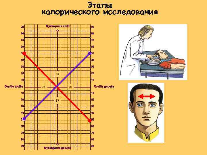 Этапы калорического исследования 