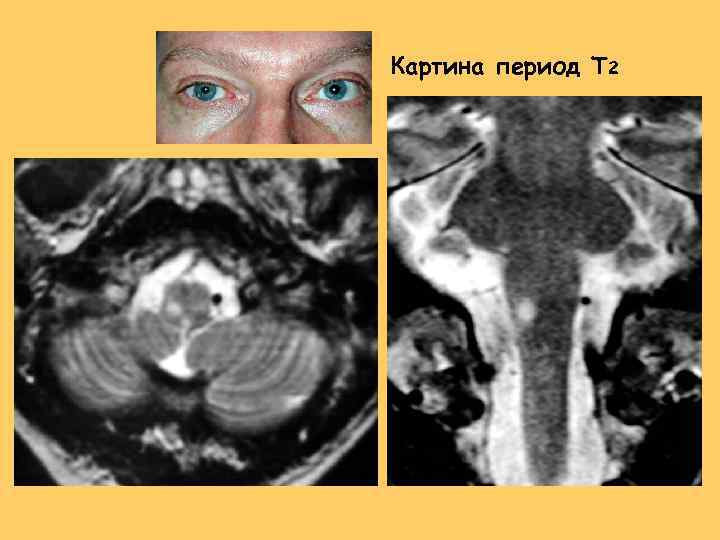 Картина период T 2 