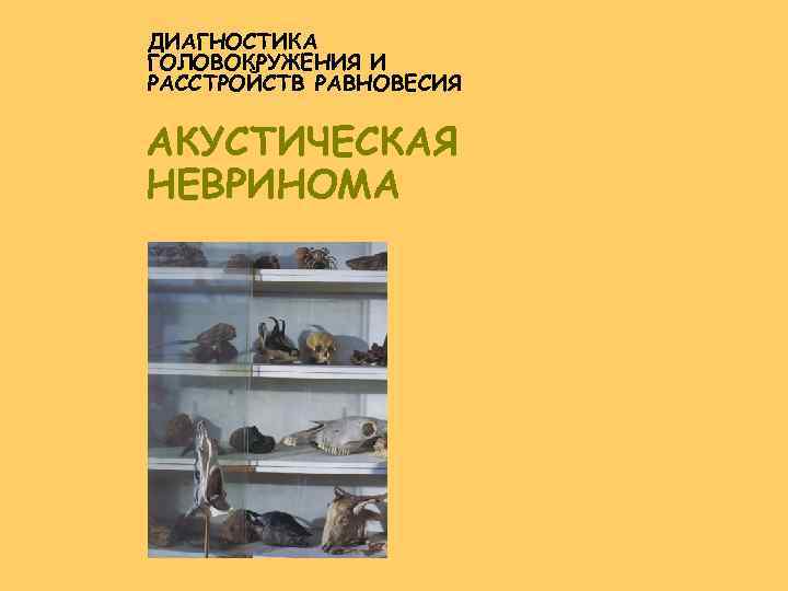 ДИАГНОСТИКА ГОЛОВОКРУЖЕНИЯ И РАССТРОЙСТВ РАВНОВЕСИЯ АКУСТИЧЕСКАЯ НЕВРИНОМА 