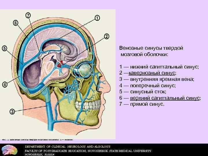  Венозные синусы твердой мозговой оболочки: 1 — нижний сагиттальный синус; 2 —кавернозный синус;