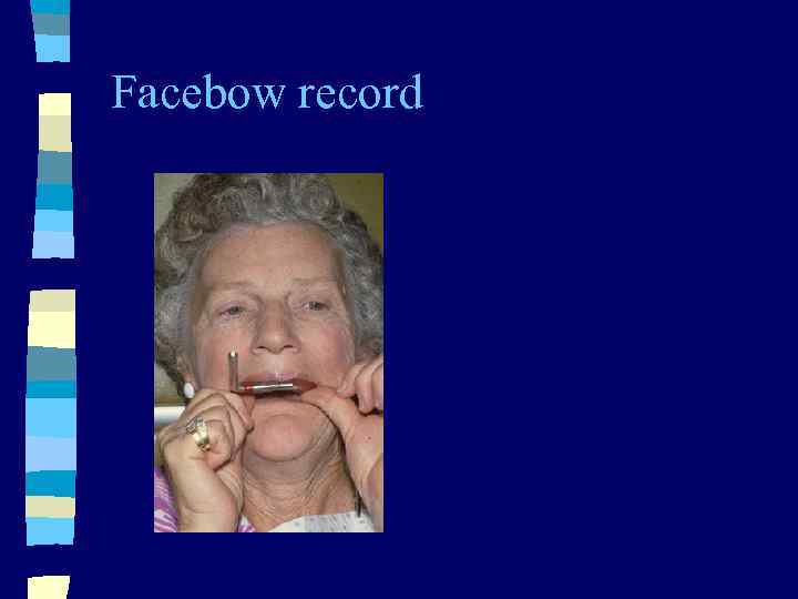 Facebow record 