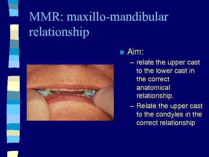 MMR: maxillo-mandibular relationship n Aim: – relate the upper cast to the lower cast
