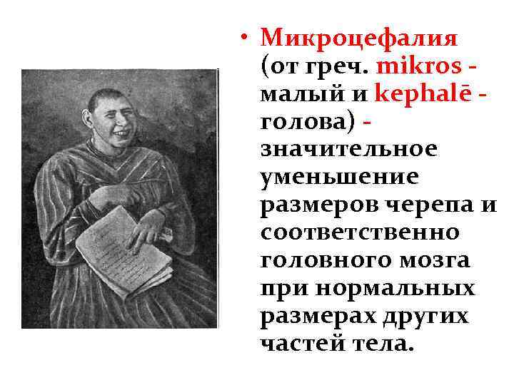  • Микроцефалия (от греч. mikros малый и kephalē голова) значительное уменьшение размеров черепа
