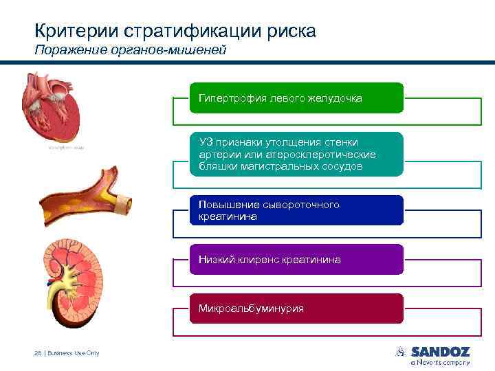 Критерии стратификации риска Поражение органов-мишеней Гипертрофия левого желудочка УЗ признаки утолщения стенки артерии или