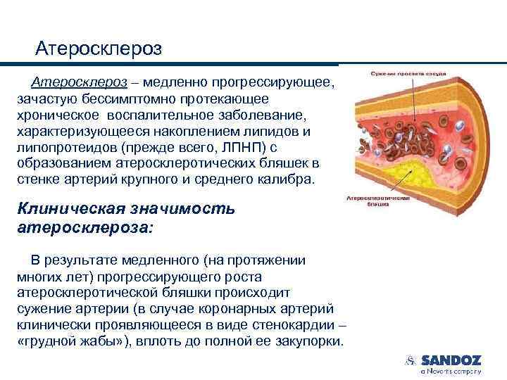 Микроскопическая картина атеросклероза аорты