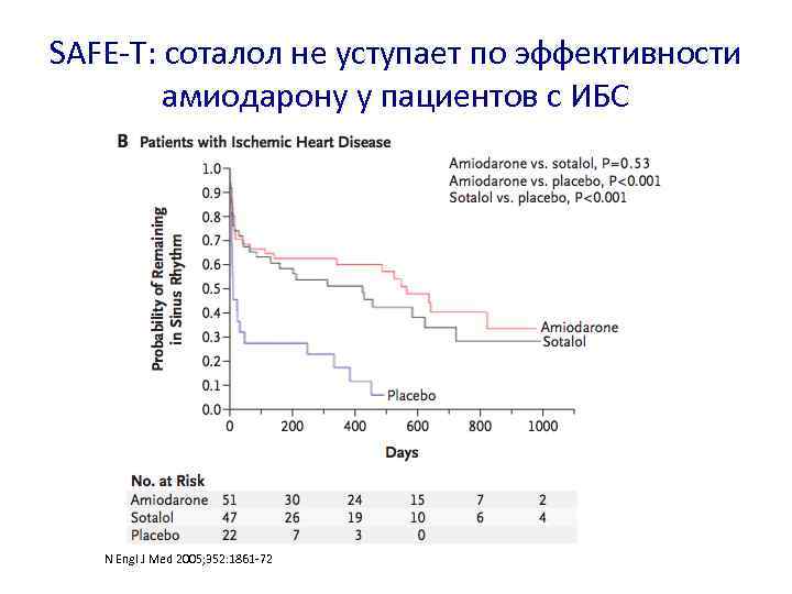 SAFE-T: соталол не уступает по эффективности амиодарону у пациентов с ИБС N Engl J