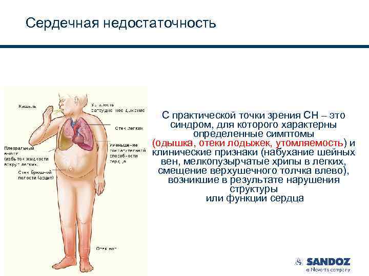 Сердечная недостаточность С практической точки зрения СН – это синдром, для которого характерны определенные