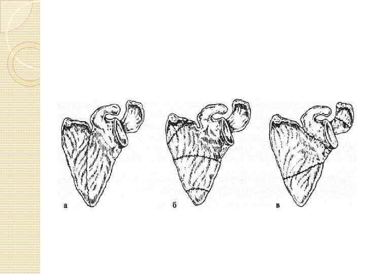 Переломы лопатки презентация