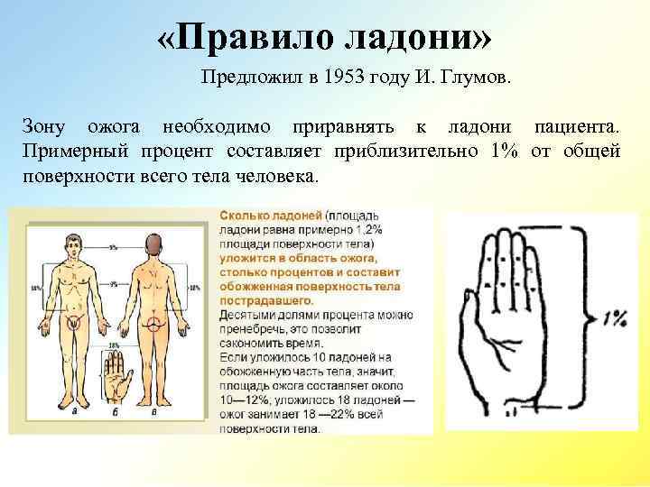  «Правило ладони» Предложил в 1953 году И. Глумов. Зону ожога необходимо приравнять к