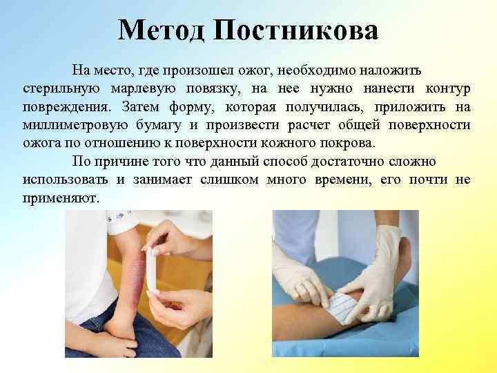 Метод Постникова На место, где произошел ожог, необходимо наложить стерильную марлевую повязку, на нее