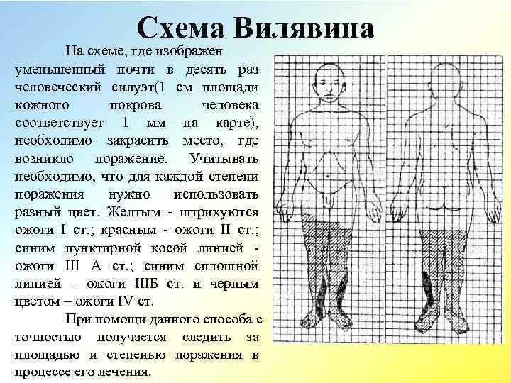 Оценка площади ожога проводится по схеме