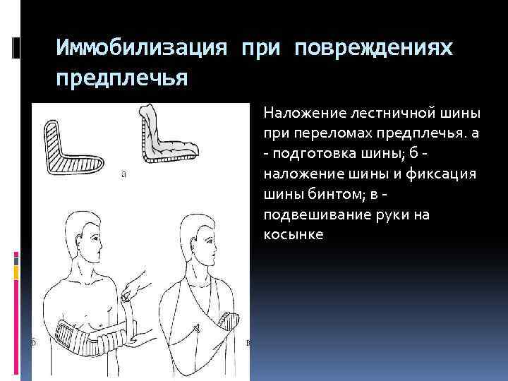 Травмы предплечья презентация