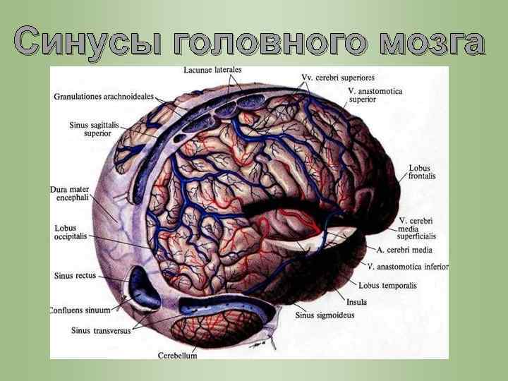 Синусы головного мозга 
