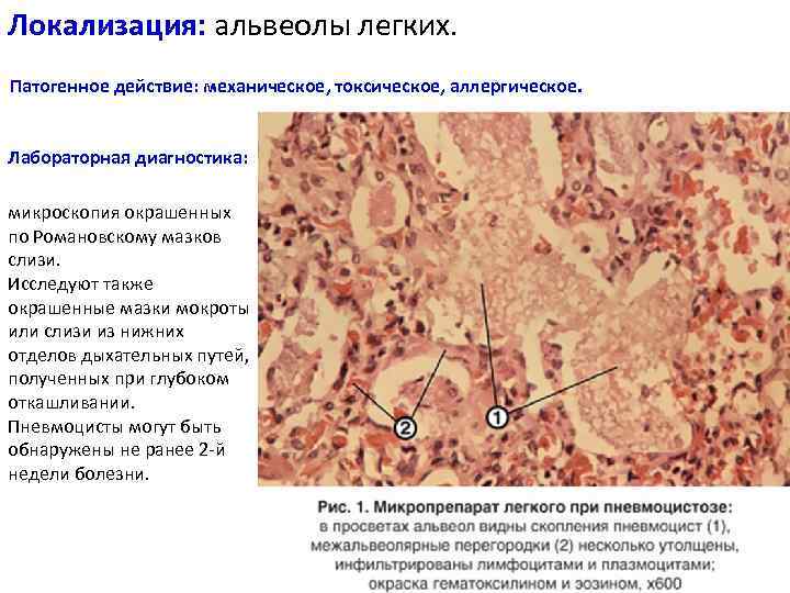 Инвазионная стадия при балантидиазе