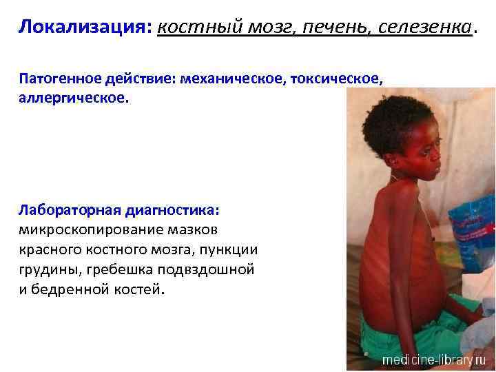 Локализация: костный мозг, печень, селезенка. Патогенное действие: механическое, токсическое, аллергическое. Лабораторная диагностика: микроскопирование мазков