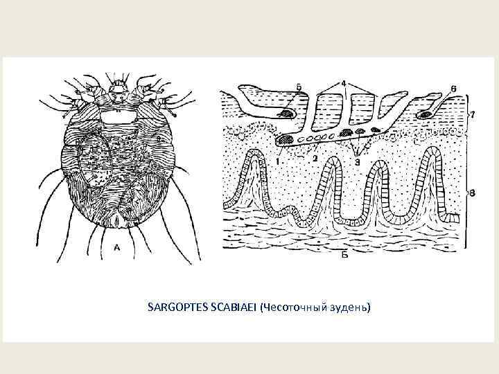 SARGOPTES SCABIAEI (Чесоточный зудень) 